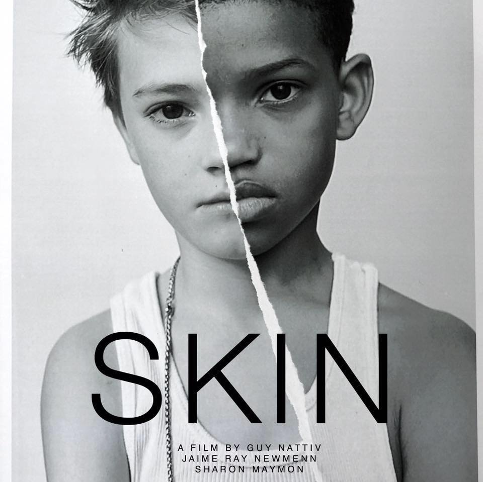 Skin Short Film (Live Action) Oscar Nominees 2019